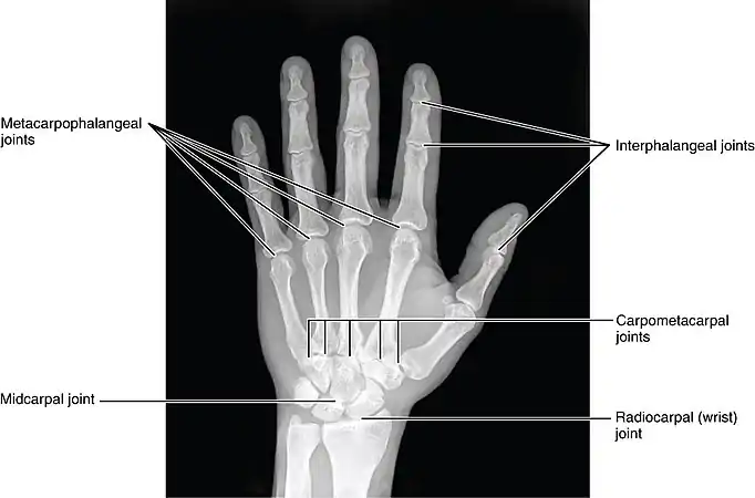 Joints of the hand in an X-ray image