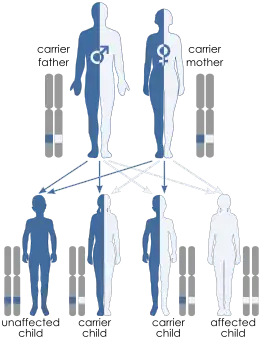 Illustration of autosomal recessive inheritance. Each parent has one blue allele and one white allele. Each of their 4 children inherit one allele from each parent such that one child ends up with two blue alleles, one child has two white alleles and two children have one of each allele. Only the child with both blue alleles shows the trait because the trait is recessive.