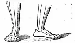 German bear-claw shoe, 1800s illustration