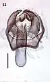 Male genitalia