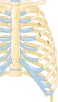 Illustration showing rib fracture at 3rd, 4th and 5th rib