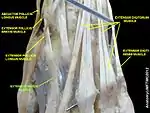 Extensor indicis muscle