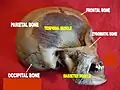 Masseter muscle. Deep dissection. Mummification process.