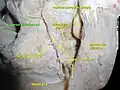 Superior labial artery