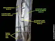 Extensor carpi radialis brevis muscle