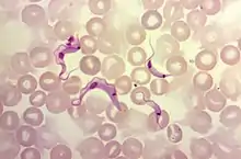 Four T. cruzi parasites surrounded by red blood cells. Undulating membranes, flagella, and kinetoplasts are visible.