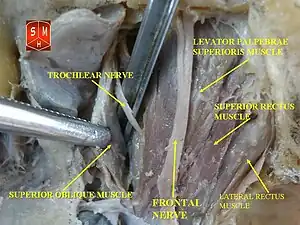 Levator palpebrae superioris muscle